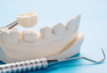 The Price of Restoration: What Dental Crowns Reveal About Our Relationship with Self-Care