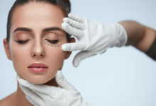 Is Blepharoplasty in Dubai the Right Choice for Brighter, Younger Looking Eyes?