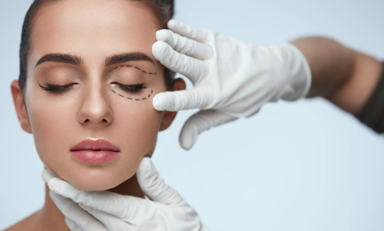 Is Blepharoplasty in Dubai the Right Choice for Brighter, Younger Looking Eyes?