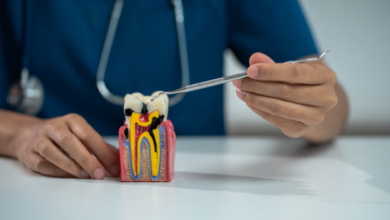 How Early Intervention at The Dental Roots Improves Treatment Outcomes