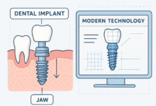 The Future of Tooth Replacement: Modern Advances in Dental Implant Technology