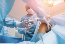 Intramedullary Nail Removal: Techniques and Considerations in Orthopedic Surgery