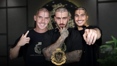 Top 10 Hair Transplant Clinics in Turkey 2026