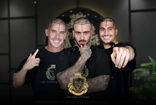 Top 10 Hair Transplant Clinics in Turkey 2026
