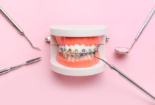 Emergency Braces Help in Thornton: What to Do If Something Breaks