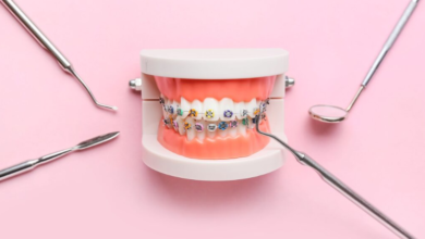 Emergency Braces Help in Thornton: What to Do If Something Breaks