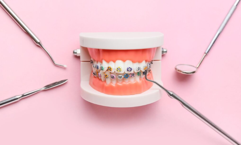 Emergency Braces Help in Thornton: What to Do If Something Breaks