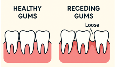 The Connection Between Gum Health and Tooth Stability