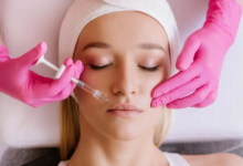 5 Things to Consider Before Scheduling Lip Injections in Phoenix
